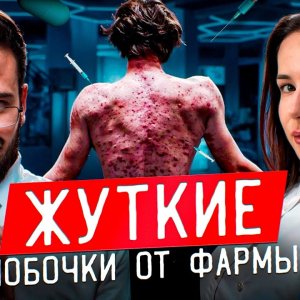 ПОБОЧКИ ОТ СТЕРОИДОВ | ПОБОЧНЫЕ ЭФФЕКТЫ ОТ ФАРМЫ